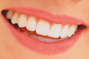 aesthetische-zahnmedizin-small